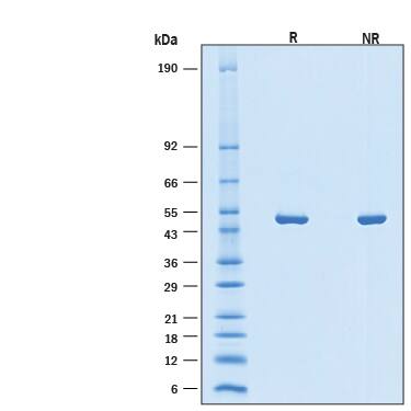 2 μg/lane of Recombinant SARS-CoV-2 BA.2 Nucleocapsid His-tag Protein (Catalog # 11182-CV) was resolved with SDS-PAGE under reducing (R) and non-reducing (NR) conditions and visualized by Coomassie® Blue staining, showing bands at 45-55 kDa.