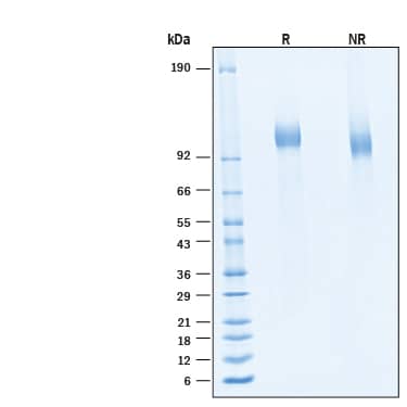 2 μg/lane of Recombinant SARS-CoV-2 BA.4/BA.5 Spike S1 Subunit His-tag Protein (Catalog # 11184-CV) was resolved with SDS-PAGE under reducing (R) and non-reducing (NR) conditions and visualized by Coomassie® Blue staining, showing bands at 103-114 kDa.