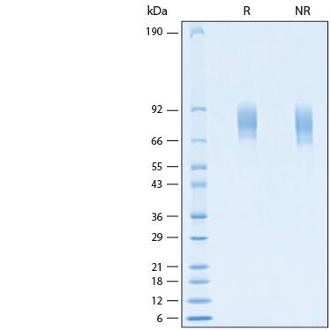 2 μg/lane of Recombinant Human ALCAM/CD166 His-tag Protein (Catalog # 11191-AL) was resolved with SDS-PAGE under reducing (R) and non-reducing (NR) conditions and visualized by Coomassie® Blue staining, showing bands at 65-85 kDa.