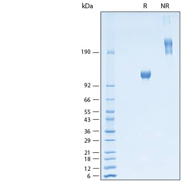 2 μg/lane of Recombinant Rat Osteoactivin/GPNMB Fc Chimera Protein (Catalog # 11203-AC) was resolved with SDS-PAGE under reducing (R) and non-reducing (NR) conditions and visualized by Coomassie® Blue staining, showing bands at 100-122 kDa and 200-240 kDa, respectively.