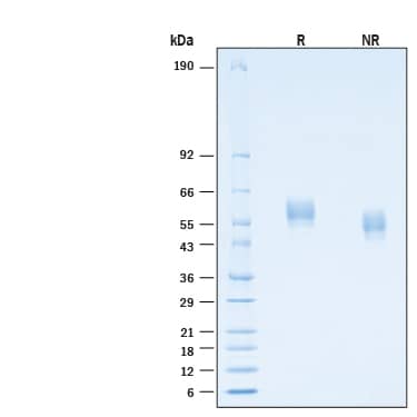 2 μg/lane of Recombinant Human IL‑18 R beta /IL‑1 R7 His-tag Protein (Catalog # 11210-AP) was resolved with SDS-PAGE under reducing (R) and non-reducing (NR) conditions and visualized by Coomassie® Blue staining, showing bands at 46-61 kDa.
