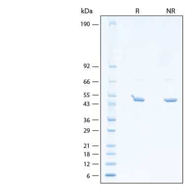 2 μg/lane of Recombinant Human SARS-CoV-2 B.1.2 (+D399N) N (1-419) Protein (Catalog # 11216-CV) was resolved with SDS-PAGE under reducing (R) and non-reducing (NR) conditions and visualized by Coomassie® Blue staining, showing bands at 44-54 kDa.