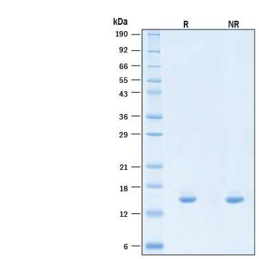 2 μg/lane of Recombinant Human IL‑2 (C145S, HEK293-expressed) Protein (Catalog # 11218-IL) was resolved with SDS-PAGE under reducing (R) and non-reducing (NR) conditions and visualized by Coomassie® Blue staining, showing bands at 14-18 kDa.