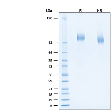 2 μg/lane of Recombinant SARS-CoV-2 XD Spike S1 Subunit His-tag Protein (Catalog # 11219-CV) was resolved with SDS-PAGE under reducing (R) and non-reducing (NR) conditions and visualized by Coomassie® Blue staining, showing bands at 101-112 kDa.