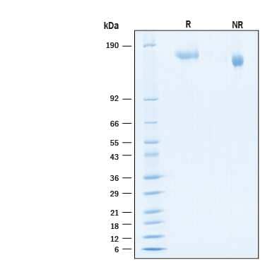 2 μg/lane of Recombinant SARS-CoV-2 BA.4/BA.5 Spike His-tag Protein (Catalog # 11232-CV) was resolved with SDS-PAGE under reducing (R) and non-reducing (NR) conditions and visualized by Coomassie® Blue staining, showing bands at 152-174 kDa.