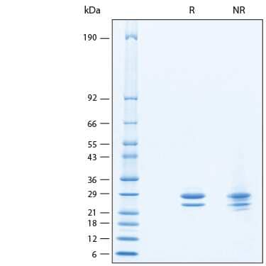 SDS-Page FGF-9 [Unconjugated]