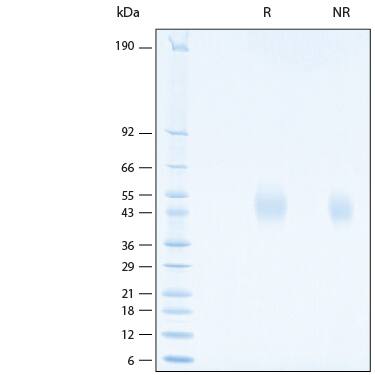 SDS-Page IL-18 BPa/IL18BP [Unconjugated]