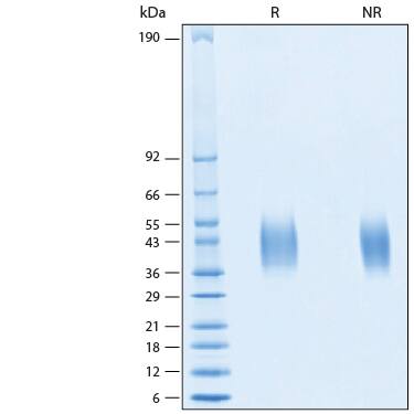 2 μg/lane of Recombinant Human IL-20R alpha His-tag Protein (Catalog # 11239-IR) was resolved with SDS-PAGE under reducing (R) and non-reducing (NR) conditions and visualized by Coomassie® Blue staining, showing bands at 34-45 kDa.