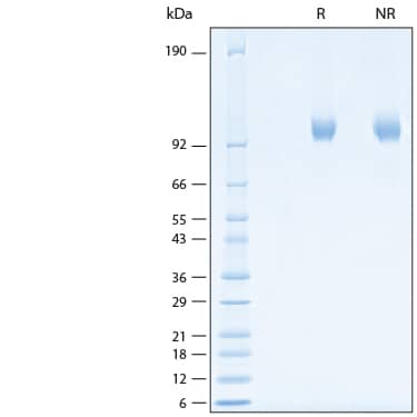 2 μg/lane of Recombinant Human DPPIV/CD26 His-tag Protein (Catalog # 11244-SE) was resolved with SDS-PAGE under reducing (R) and non-reducing (NR) conditions and visualized by Coomassie® Blue staining, showing bands at 96-108 kDa.