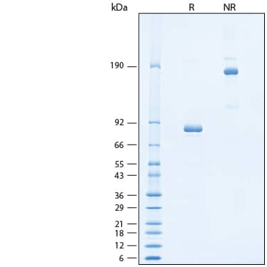 2 μg/lane of Recombinant Mouse TAPBPR Fc Chimera Protein (Catalog # 11254-TP) was resolved with SDS-PAGE under reducing (R) and non-reducing (NR) conditions and visualized by Coomassie® Blue staining, showing bands at 75-90 kDa and 150-180 kDa, respectively.