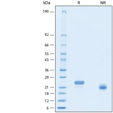 2 μg/lane of Recombinant Human ULBP-3 His-tag Protein (Catalog # 11255-UL) was resolved with SDS-PAGE under reducing (R) and non-reducing (NR) conditions and visualized by Coomassie® Blue staining, showing bands at 20-27 kDa.