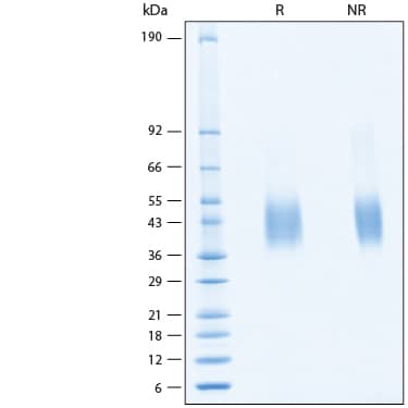 SDS-PAGE Monkeypox Virus E8L [Unconjugated]