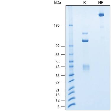 2 μg/lane of Recombinant Cynomolgus HGFR/c-MET Fc Chimera Protein (Catalog # 11267-ME) was resolved with SDS-PAGE  and visualized by Coomassie® Blue staining, showing bands at 135-150 kDa, 40-45 kDa, and 103-115 kDa under reducing (R) conditions and a single band at 270-310 kDa under non-reducing (NR) conditions.