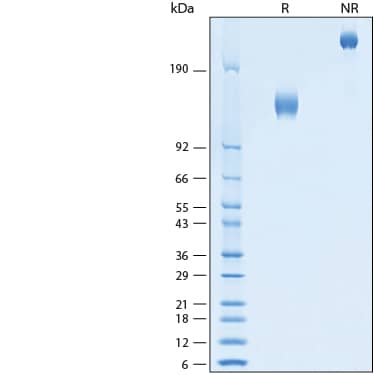 2 μg/lane of Recombinant Human IL-1 RAcP/IL-1 R3 ST2/IL-33R Fc Chimera Protein (Catalog # 11268-CP) was resolved with SDS-PAGE under reducing (R) and non-reducing (NR) conditions and visualized by Coomassie® Blue staining, showing bands at 130-144 kDa.