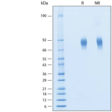 2 μg/lane of Recombinant Human IL-27 Ra/WSX-1/TCCR His-tag Protein (Catalog # 11270-TC) was resolved with SDS-PAGE under reducing (R) and non-reducing (NR) conditions and visualized by Coomassie® Blue staining, showing bands at 76-88 kDa.