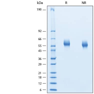 2 μg/lane of Recombinant Human ST2/IL-33R His-tag Protein (Catalog # 11272-ST) was resolved with SDS-PAGE under reducing (R) and non-reducing (NR) conditions and visualized by Coomassie® Blue staining, showing bands at 55-62 kDa.