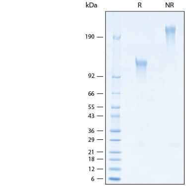 2 μg/lane of Recombinant Human TIM-1/KIM-1/HAVCR (175 aa) Fc Chimera Protein (Catalog # 11273-TM) was resolved with SDS-PAGE under reducing (R) and non-reducing (NR) conditions and visualized by Coomassie® Blue staining, showing bands at 113-132 kDa and 230-260 kDa, respectively.