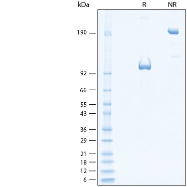 2 μg/lane of Recombinant Human EphB4 Fc Chimera Protein (Catalog # 11307-B4) was resolved with SDS-PAGE under reducing (R) and non-reducing (NR) conditions and visualized by Coomassie® Blue staining, showing bands at 95-108 kDa and 190-220 kDa, respectively.