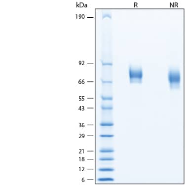 2 μg/lane of Recombinant Human IL-12 R beta 1 His-tag Protein (Catalog # 11310-B1) was resolved with SDS-PAGE under reducing (R) and non-reducing (NR) conditions and visualized by Coomassie® Blue staining, showing bands at 62-79 kDa.