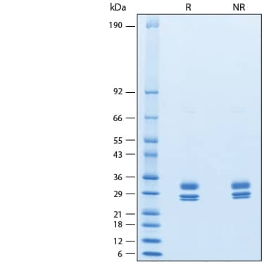 2 μg/lane of Recombinant Human IL-27 (EBI3 + p28 Heterodimer) Protein (Catalog # 11312-IL) was resolved with SDS-PAGE under reducing (R) and non-reducing (NR) conditions and visualized by Coomassie® Blue staining, showing bands at 30-34 kDa (EBI3) and 24-29 kDa (p28).