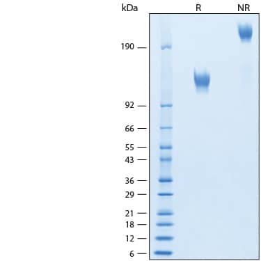 2 μg/lane of Recombinant Mouse Mer Fc (HEK293-expressed) Protein (Catalog # 11314-MR) was resolved with SDS-PAGE under reducing (R) and non-reducing (NR) conditions and visualized by Coomassie® Blue staining, showing bands at 114-131 kDa and 228-262 kDa, respectively.