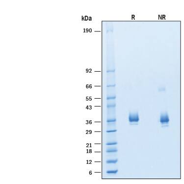 2 μg/lane of Recombinant SARS-CoV-2 XBB.1 Spike RBD His-tag Protein (Catalog # 11330-CV) was resolved with SDS-PAGE under reducing (R) and non-reducing (NR) conditions and visualized by Coomassie® Blue staining, showing bands at 30-37 kDa.