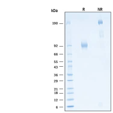 2 μg/lane of Recombinant Human LRRTM3 Fc Chimera Protein (Catalog # 11357-LR) was resolved with SDS-PAGE under reducing (R) and non-reducing (NR) conditions and visualized by Coomassie® Blue staining, showing bands at 76-93 kDa and 150-190 kDa, respectively.