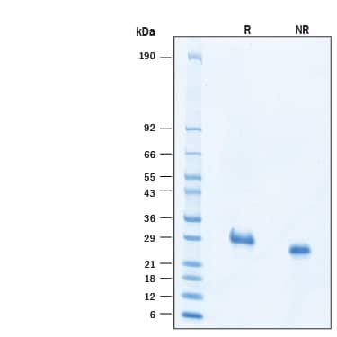 2 μg/lane of Recombinant Human EDA2R/TNFRSF27/XEDAR His-tag Protein (Catalog # 11358-XD) was resolved with SDS-PAGE under reducing (R) and non-reducing (NR) conditions and visualized by Coomassie® Blue staining, showing bands at 26‑30 kDa.