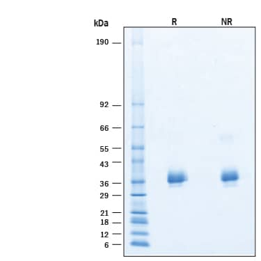 2 μg/lane of Recombinant SARS-CoV-2 XBB.1.5 Spike RBD His-tag Protein (Catalog # 11360-CV) was resolved with SDS-PAGE under reducing (R) and non-reducing (NR) conditions and visualized by Coomassie® Blue staining, showing bands at 30-39 kDa.
