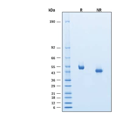 2 μg/lane of Recombinant Mouse IL‑5 R alpha /CD125 His-tag Protein (Catalog # 11367-5R) was resolved with SDS-PAGE under reducing (R) and non-reducing (NR) conditions and visualized by Coomassie® Blue staining, showing bands at 48-54 kDa.