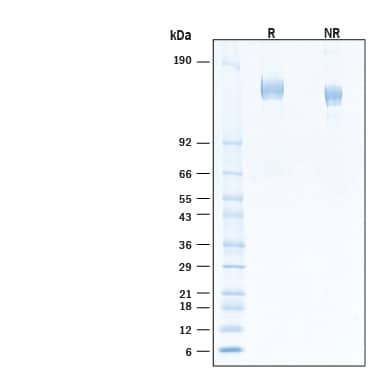 2 μg/lane of Recombinant SARS-CoV-2 XBB.1 Spike (GCN4-IZ) His-tag Protein (Catalog # 11371-CV) was resolved with SDS-PAGE under reducing (R) and non-reducing (NR) conditions and visualized by Coomassie® Blue staining, showing bands at 143-167 kDa.