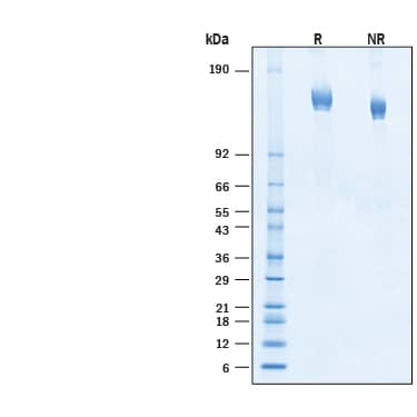 2 μg/lane of Recombinant SARS-CoV-2 XBB.1.5 Spike (GCN4-IZ) His-tag Protein (Catalog # 11372-CV) was resolved with SDS-PAGE under reducing (R) and non-reducing (NR) conditions and visualized by Coomassie® Blue staining, showing bands at 133‑167 kDa.