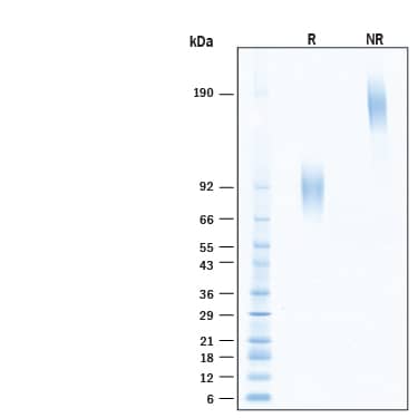2 μg/lane of Recombinant Human Neuregulin‑3/NRG3 Fc Chimera Protein (Catalog # 11373-NR) was resolved with SDS-PAGE under reducing (R) and non-reducing (NR) conditions and visualized by Coomassie® Blue staining, showing bands at 90-100 kDa and 180-200 kDa, respectively.