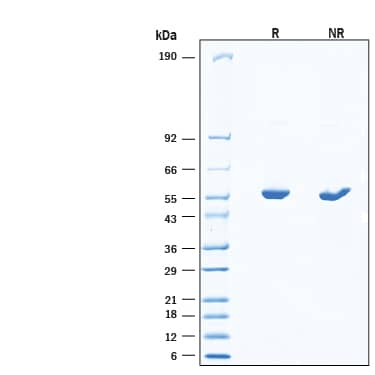 2 μg/lane of Recombinant Coliphage K5 Lyase His-tag Protein (Catalog # 11384-K5) was resolved with SDS-PAGE under reducing (R) and non-reducing (NR) conditions and visualized by Coomassie® Blue staining, showing bands at 54-60 kDa under reducing conditions.