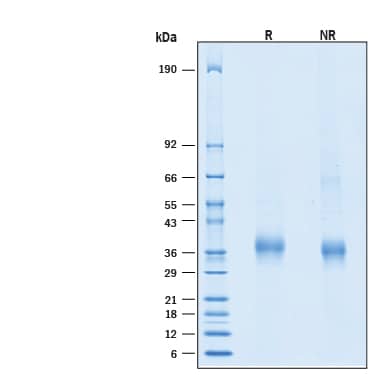 2 μg/lane of Recombinant Cynomolgus Monkey BLAME/SLAMF8 His-tag Protein (Catalog # 11395-BL) was resolved with SDS-PAGE under reducing (R) and non-reducing (NR) conditions and visualized by Coomassie® Blue staining, showing bands at 31-39 kDa, under reducing conditions.