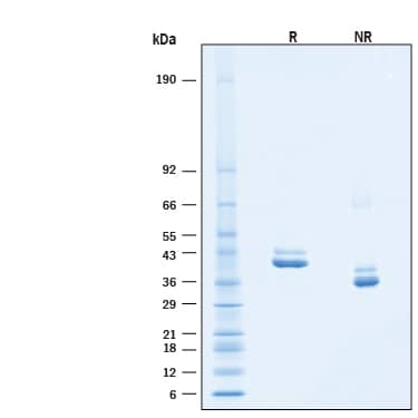 2 μg/lane of Recombinant Human IL‑12/IL‑23 p40 Protein (Catalog # 11407-IL) was resolved with SDS-PAGE under reducing (R) and non-reducing (NR) conditions and visualized by Coomassie® Blue staining, showing bands at 38-45 kDa, under reducing conditions.