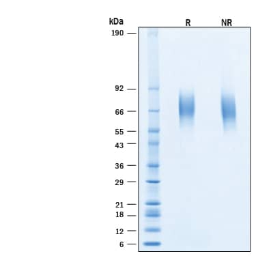 2 μg/lane of Recombinant Human IL-23R His-tag Protein (Catalog # 11408-IR) was resolved with SDS-PAGE under reducing (R) and non-reducing (NR) conditions and visualized by Coomassie® Blue staining, showing bands at 66-74 kDa, under reducing conditions.