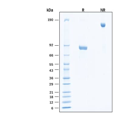 2 μg/lane of Recombinant Human GFR alpha ‑1/GDNF R alpha ‑1 Fc Chimera Protein (Catalog # 11419-GR) was resolved with SDS-PAGE under reducing (R) and non-reducing (NR) conditions and visualized by Coomassie® Blue staining, showing bands at 77-90 kDa and 150-180 kDa, respectively.