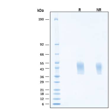 2 μg/lane of Recombinant Human NRG1-beta 1/HRG1-beta 1 His-tag Protein (Catalog # 11422-NR) was resolved with SDS-PAGE under reducing (R) and non-reducing (NR) conditions and visualized by Coomassie® Blue staining, showing bands at 36-49 kDa, under reducing conditions.