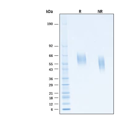 2 μg/lane of Recombinant Human IL‑13 R alpha 1 His-tag Protein (Catalog # 11424-IR) was resolved with SDS-PAGE under reducing (R) and non-reducing (NR) conditions and visualized by Coomassie® Blue staining, showing bands at 58-64 kDa, under reducing conditions.