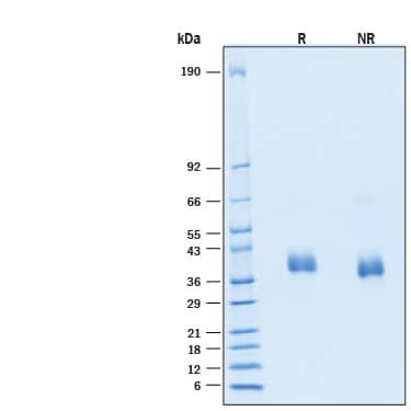 2 μg/lane of Recombinant SARS-CoV-2 BA.2.86 Spike RBD His-tag Protein (Catalog # 11440-CV) was resolved with SDS-PAGE under reducing (R) and non-reducing (NR) conditions and visualized by Coomassie® Blue staining, showing bands at 36 - 40 kDa.
