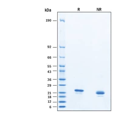 2 μg/lane of Recombinant Human IL‑34 His-tag Protein (Catalog # 11449-IL) was resolved with SDS-PAGE under reducing (R) and non-reducing (NR) conditions and visualized by Coomassie® Blue staining, showing bands at 19‑25 kDa, under reducing conditions.