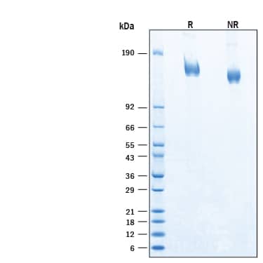 2 μg/lane of Recombinant SARS-CoV-2 EG.5.1 Spike His-tag Protein (Catalog # 11451-CV) was resolved with SDS-PAGE under reducing (R) and non-reducing (NR) conditions and visualized by Coomassie® Blue staining, showing bands at 140 - 160 kDa.