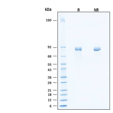 2 μg/lane of Recombinant Human Periostin/OSF‑2 (C60A) His-tag Protein (Catalog # 11486-F2) was resolved with SDS-PAGE under reducing (R) and non-reducing (NR) conditions and visualized by Coomassie® Blue staining, showing bands at 68-90 kDa, under reducing conditions.