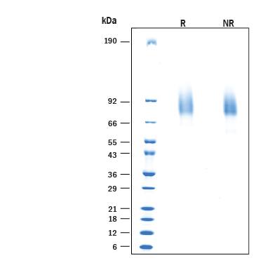 SDS-PAGE Saccharomyces Cerevisiae [Unconjugated]