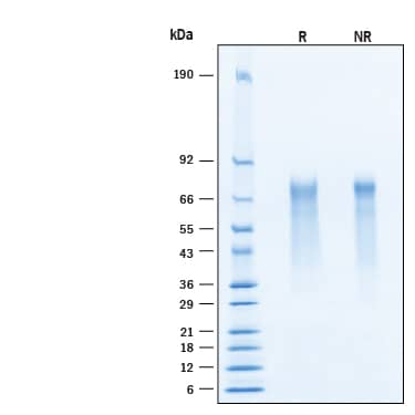 2 μg/lane of Recombinant Human Neuregulin‑3/NRG3 His-tag Protein (Catalog # 11520-NR) was resolved with SDS-PAGE under reducing (R) and non-reducing (NR) conditions and visualized by Coomassie® Blue staining, showing bands at 35-74 kDa, under reducing conditions.