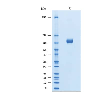 2 μg/lane of Recombinant Human BTN2A1 Fc Chimera Protein (Catalog # 11521-BT) was resolved with SDS-PAGE under reducing (R) condition and visualized by Coomassie® Blue staining, showing bands at 60-80 kDa.