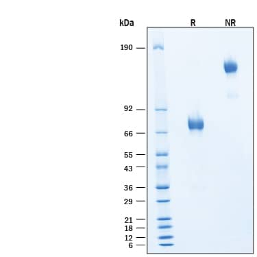 2 μg/lane of Recombinant Cynomolgus Monkey IL-4R alpha Fc Chimera Protein (Catalog # 11532-4R) was resolved with SDS-PAGE under reducing (R) and non-reducing (NR) conditions and visualized by Coomassie® Blue staining, showing bands at 70-79 kDa and 140-160 kDa, respectively.