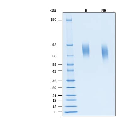 2 μg/lane of Recombinant Human TrkB His-tag Protein (Catalog # 11549-TK) was resolved with SDS-PAGE under reducing (R) and non-reducing (NR) conditions and visualized by Coomassie® Blue staining, showing bands at 74-82 kDa, under reducing conditions.