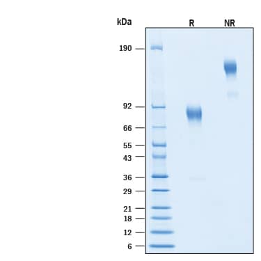 2 μg/lane of Recombinant Human Fc epsilon RI alpha Fc Chimera Protein (Catalog # 11561-FC) was resolved with SDS-PAGE under reducing (R) and non-reducing (NR) conditions and visualized by Coomassie® Blue staining, showing bands at 78-86 kDa and 160-170 kDa, respectively.